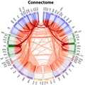 featured image thumbnail for post Introduction to brain connectivity and disconnectivity